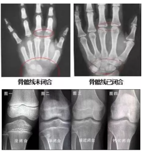 上海六一儿童医院助力小孩实现身高增长