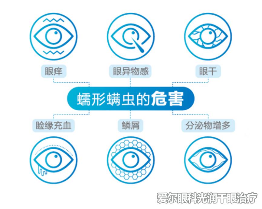 螨虫螨虫可致干眼症