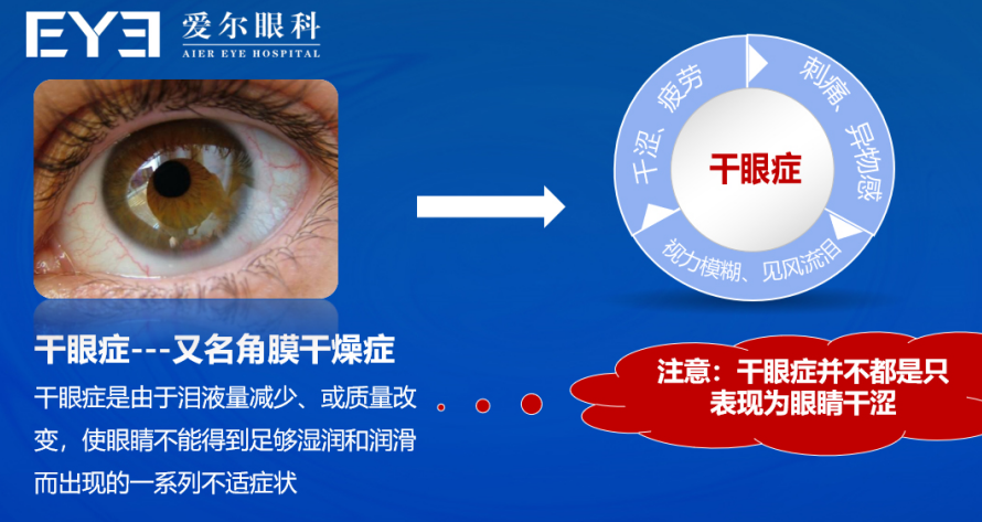 眼睛除螨虫、眼睛干燥、眼睛干痒、眼睛疲劳，爱尔眼科为五年干眼患者进行干眼症治疗