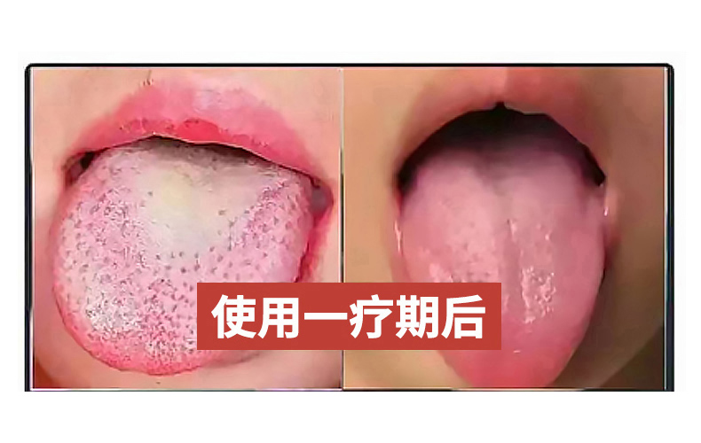 同旭堂同湿散真的靠谱吗？今天就来细数这些年用户怎么说