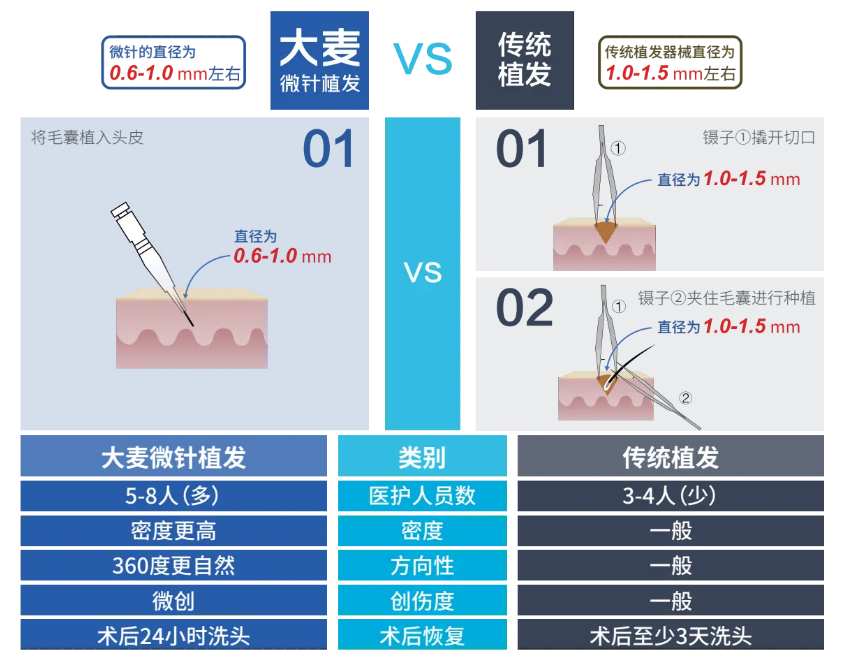 春天一到，头发猛掉？大麦微针植发来拯救你！