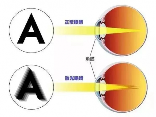 西宁爱尔眼科医院：案例分享丨近视手术不止治疗近视！