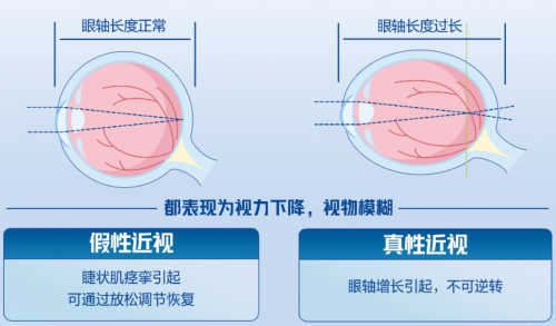 西宁爱尔眼科医院丨寒假重中之重，孩子近视管理，必须做的4项检查你知道吗？